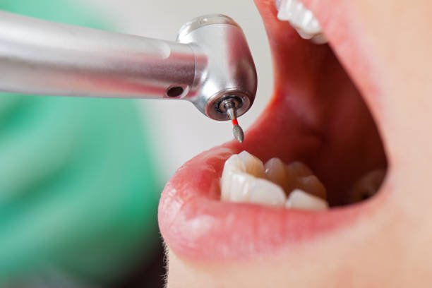 Best Emergency Treatment for Dental Infections or Abscesses in Eagle Grove, IA
